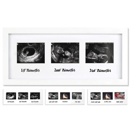 IHEIPYE Triple Sonogram Pregnancy Frame – Baby Ultrasound Picture Frame with Story for Expecting Parents, Baby Grow Through All Three Trimesters Frame, Nursery Decor, White