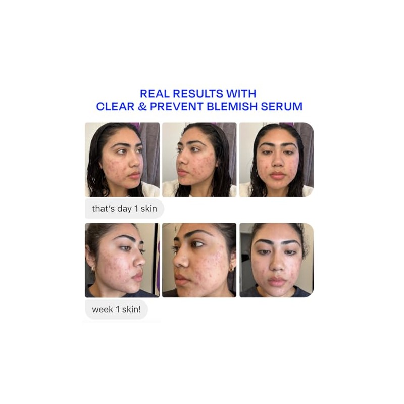 Murad Biome-Balancing Serum - Suero Facial Anti-Imperfecciones con Ácido Salicílico,