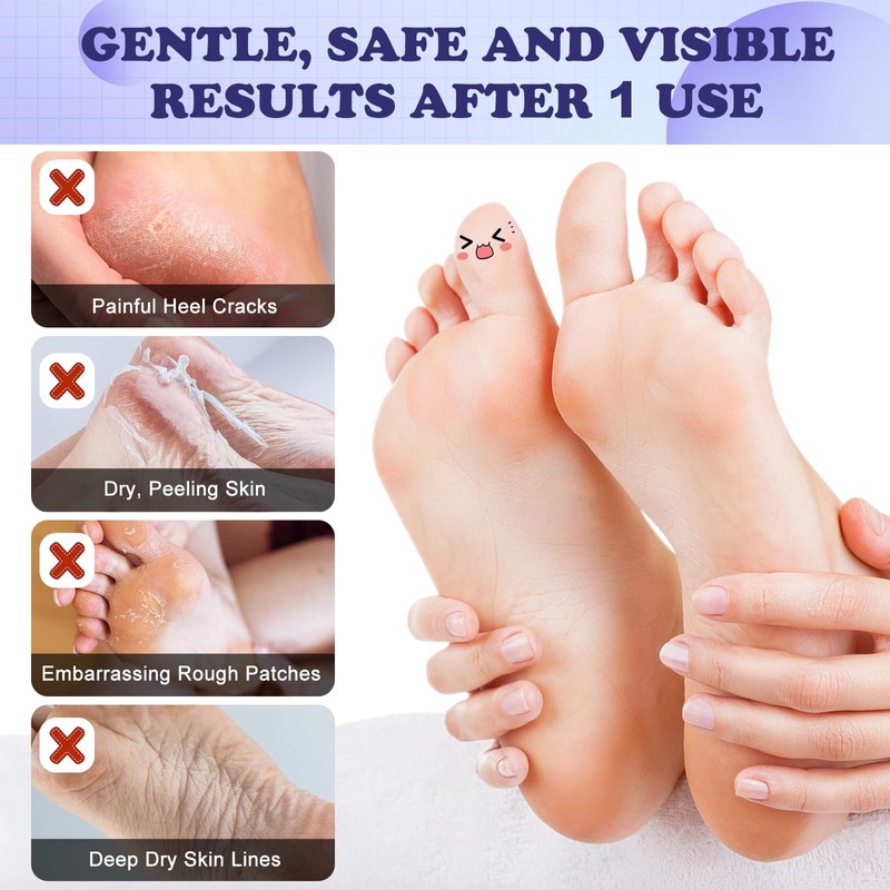 Samamoca Fußmaske 4er Set Hornhaut Socken,Exfoliating Peeling Socken gegen Hornhaut