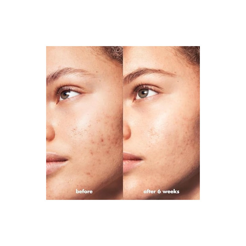 CLEANSER BB ACNE CLARIFYING