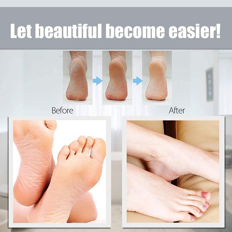 100 Pieces Foot File Refills Sandpaper Replacement Pedicure Files Refill