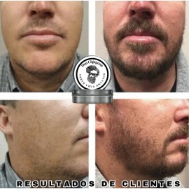 Bálsamo Para Barba Y Bigote 2 Piezas Don Chingoon Bergamota Menta