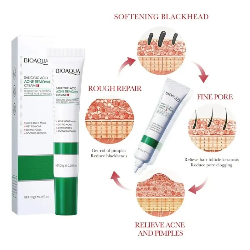 Crema De Ácido Salicílico Para El Control Del Acné Para