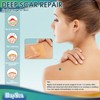 Professional Silicone Scar Sheets (1.6" x 150" Scar Roll-3.8M) -