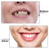 Clip in Veneers Teeth, 1 Pairs Snap on Veneers False
