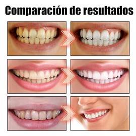Enjuague Bucal Coconut, Coconut Oil Mouthwash, Protección Contra El Mal Aliento, Enjuague Bucal con Aceite de Coco, Teeth Whitening Mouthwash With Tongue Scraper. (100ml)