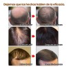 Andrea Solución Crecimiento Regenera Detiene Caída Cabello F Full
