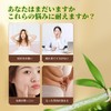 Foot Sheets, No Fire, Moxibustion, 30 Sheets (15 Feets), Foot