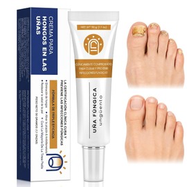 Crema para el Cuidado de las Uñas,Pomada Reparadora de Uñas,Restaura Uñas Dañadas,ingredientes naturales,Fortalece las Uñas,Mejorar el color de las uñ