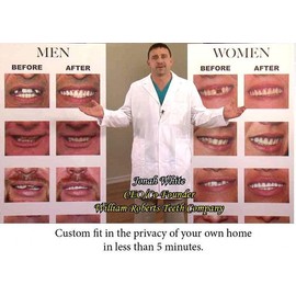 none TOP VENEERS INSTANT SMILE BEAUTIFUL TEETH new dentures COSMETIC MAKEOVER NEW