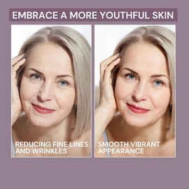 AmmuRi Anti-Aging Serum with Matrixyl 3000, Vitamin C, Hyaluronic Acid, Organic Aloe Vera, for Wrinkles, Lines, Acne, Sensitive Skin 30ml