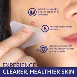 UNNIE SKIN Large Square Acne Pimple Patch Value Pack - Hydrocolloid & Salicyclic acid for clearing pimples, zits, blemishes for face and skin (20 Patches Included, 30 Days Supply)