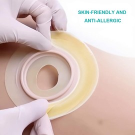 30 Pcs Ostomy Barrier Strips, Adhesive Seal Strips for Colostomy Bags, Hydrocolloid Waterproof Leak, Pressure Sensitive Adhesive Tape for Ileostomy Bags, Urostomy Barrier Tape Ostomy Supplies