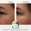 Neviderm 50 gr - Borra Cicatrices y Líneas de Expresión