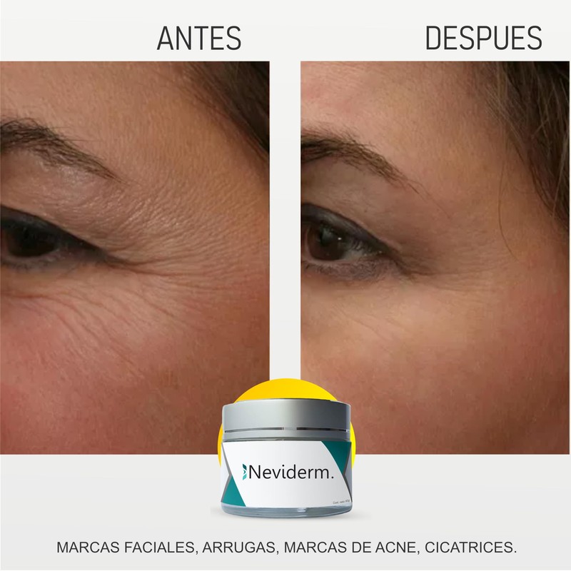 Neviderm 50 gr - Borra Cicatrices y Líneas de Expresión