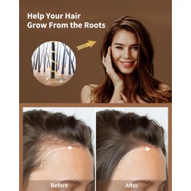 VTS Hair Oil Applicator & Rosemary Oil & Moroccan Argan Oil, Hair Serum Comb Applicator Scalp Massager for Hair Growth, Hair Care Set for Men and Women