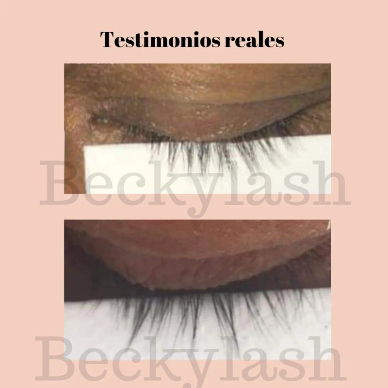 Tratamiento Alargador Para Pestañas Y Cejas Beckylash