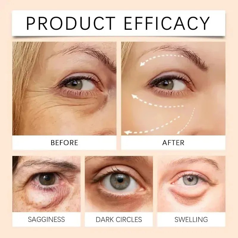 Crema Reafirmante Para Ojos Con Péptidos 5d, Hidrata La Piel