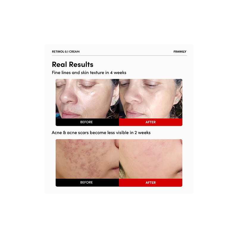 FRANKLY [FRANKLY]Retinol 0.1% Cream 30ml