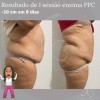 Monnaskin MESOLIPO PPC Cream Monnaskin 50g