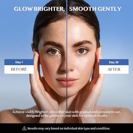 Suero corrector de manchas oscuras para cara y cuerpo – Niacinamida y vitamina C iluminador para hiperpigmentación, melasma, manchas solares, manchas 