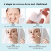 Professional Blackhead and Blemish Remover -Pimple Comedone Removal 2-in-1 Extractor