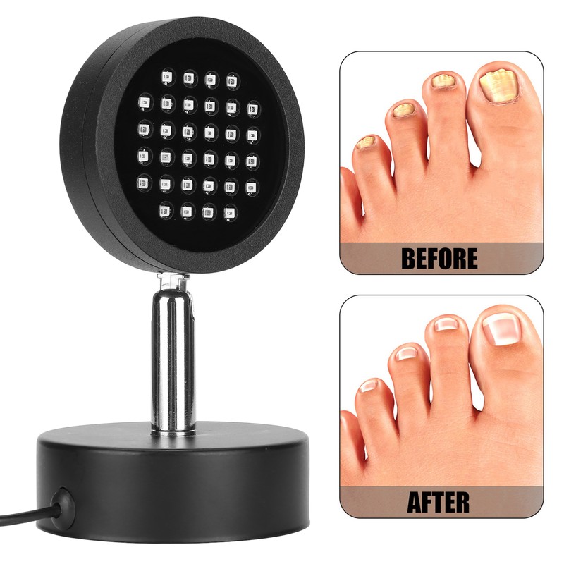 Painless Onychomycosis Remover Treatment Machine Infrared Ray Toe Finger Nail
