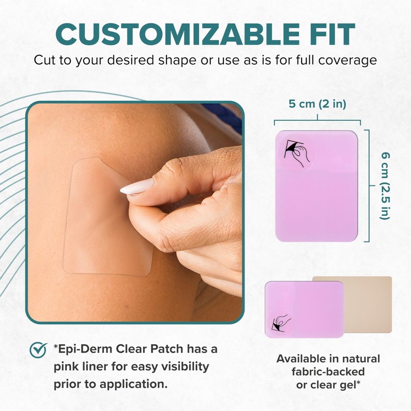 Epi-Derm Patch – Professional-Grade Silicone Scar Sheets for Small Keloid