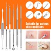 2022 Latest 15 Piece Pimple Popper Tool Set, Blackhead Remover,