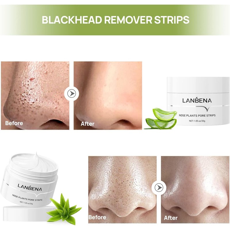 LANBENA Blackhead Remover, LANBENA Black Heads Remover from Face Black