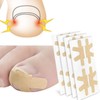 New Toenail Fixing Tape (1 Sheet, 4 Pcs) Beige 5ea
