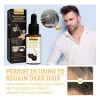 Aceite Sérum Para Cabello Gris, Tratamiento Reparador Antien