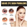 Crema Contorno Ojos | Desvanece Arrugas,bolsas + Reafirmante