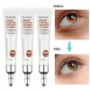 3x Crema para los ojos Bolsas para quitar instantáneamente Ojeras
