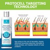 Roycederm Champú para la psoriasis, dermatitis seborreica, foliculitis y caspa,