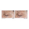 Roc Retinol Correxion- Parches Dirigido No Invasivos Arrugas