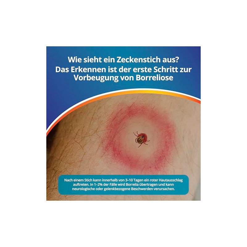 ADESTE BORRELIOSE TEST TICKS - Quick Self Test for Diagnosis