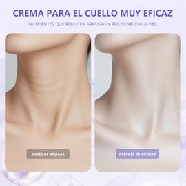 WEUD 2PCS Cremas para Cuello Reafirmante, con Hidrolizado de Acido Hialurónico, Sin Gluten, Vegano, Fórmula Suave , 100% Natural, Crema para Cuello y 