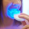 Britvae oral Care Bitvae Teeth Whitening Kit LED - New
