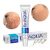 UNIVERSOENLNEA.COM 2 Crema Eliminacin De Acn - Crema para eliminar