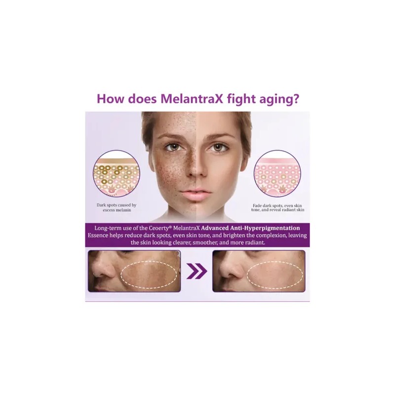 Highly Effective Anti-pigmentation Serum Whitening Blemish R