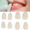 Unbranded 96PCS/Card Dental Tooth Veneer Anterior Resin Thin Teeth Veneers