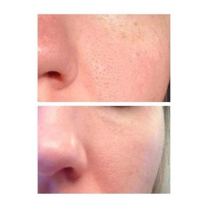 RETINOL MOISTURIZER DAY/NIGHT CREAM w/ Hyaluronic Acid - Highest Strength