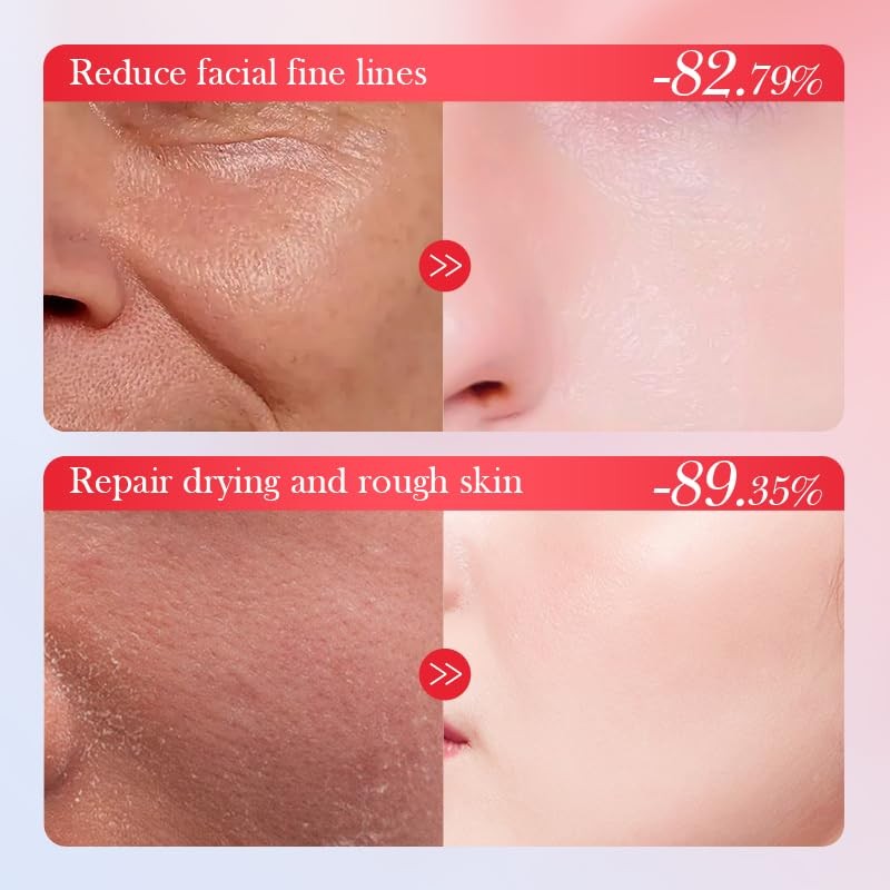 Goji Berry Anti-Wrinkle Firming Repairing Cream cares for delicate skin