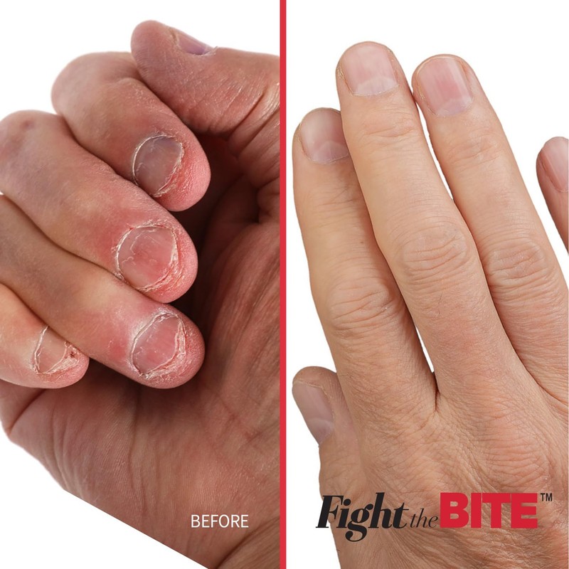 Cuccio Fight The Bite - Clear No Bite Nail Polish