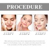 Crema For Eliminar Manchas Oscuras Y Manchas For Melasma Y