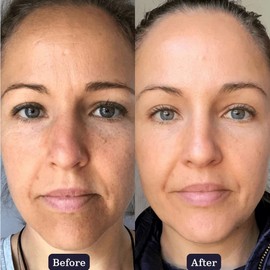 Edible Beauty Collagen Boosting Duo