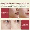 Kit De 2 Productos Para La Retina Con Nanosuero Al