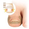 밴드 시트 4p 파고드는 교정 보호 내성발톱 테이프 [블루] Band Sheet 4p Digging Correction Protection Ingrown Toenail Tape [Blue]