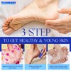 SALVMARY Disposable Pumice Stone for Feet Hard Skin Callus Remover